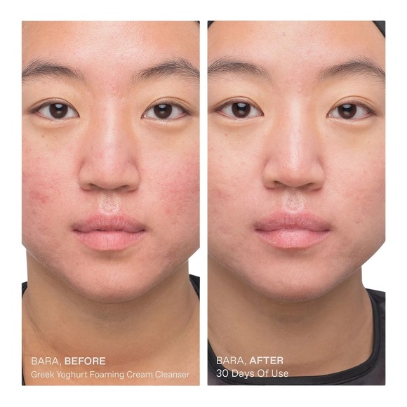 Korres Greek Yoghurt Foaming Cream Cleanser Pre + Probiotics - Picture 6 of 10